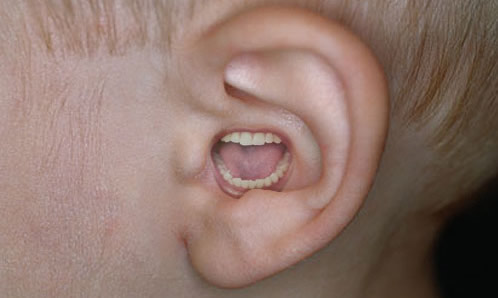 Mouth Ear 93